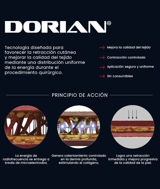 Dorian by IDM