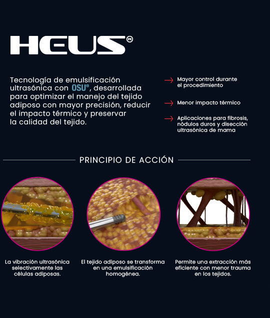 Heus by IDM